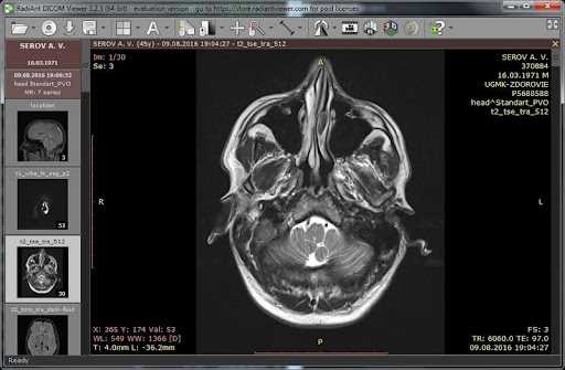 Просмотр медицинских изображений: просто и удобно
