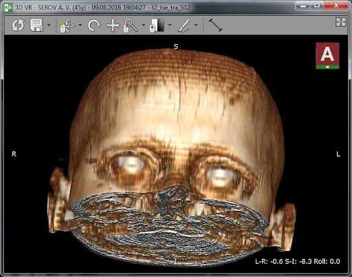 Загрузка и установка RadiAnt DICOM Viewer